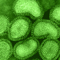 A realidade sobre a Influenza A (H1N1) em Goiás
